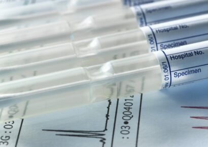 A DNS-vizsgálat igazolta, hogy a 24 éve eltűnt Till Tamás holttestét találták meg Baján