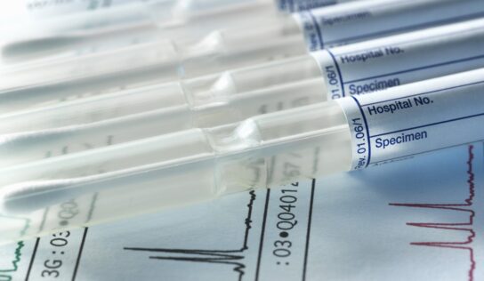 A DNS-vizsgálat igazolta, hogy a 24 éve eltűnt Till Tamás holttestét találták meg Baján