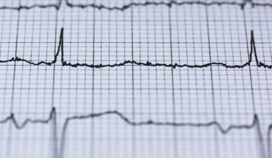 Új módszerrel gyógyítják a szívritmuszavarral élőket a PTE szakemberei