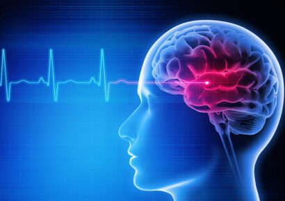 A túl kevés vagy a túl sok alvás is növeli a halálozás és a stroke kockázatát